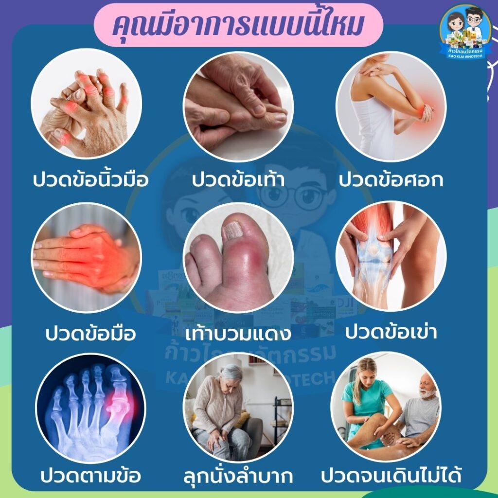 รูมาตอยด์  โรครูมาตอยด์ โรคเกาต์ ข้อเข่าเสื่อม (17)