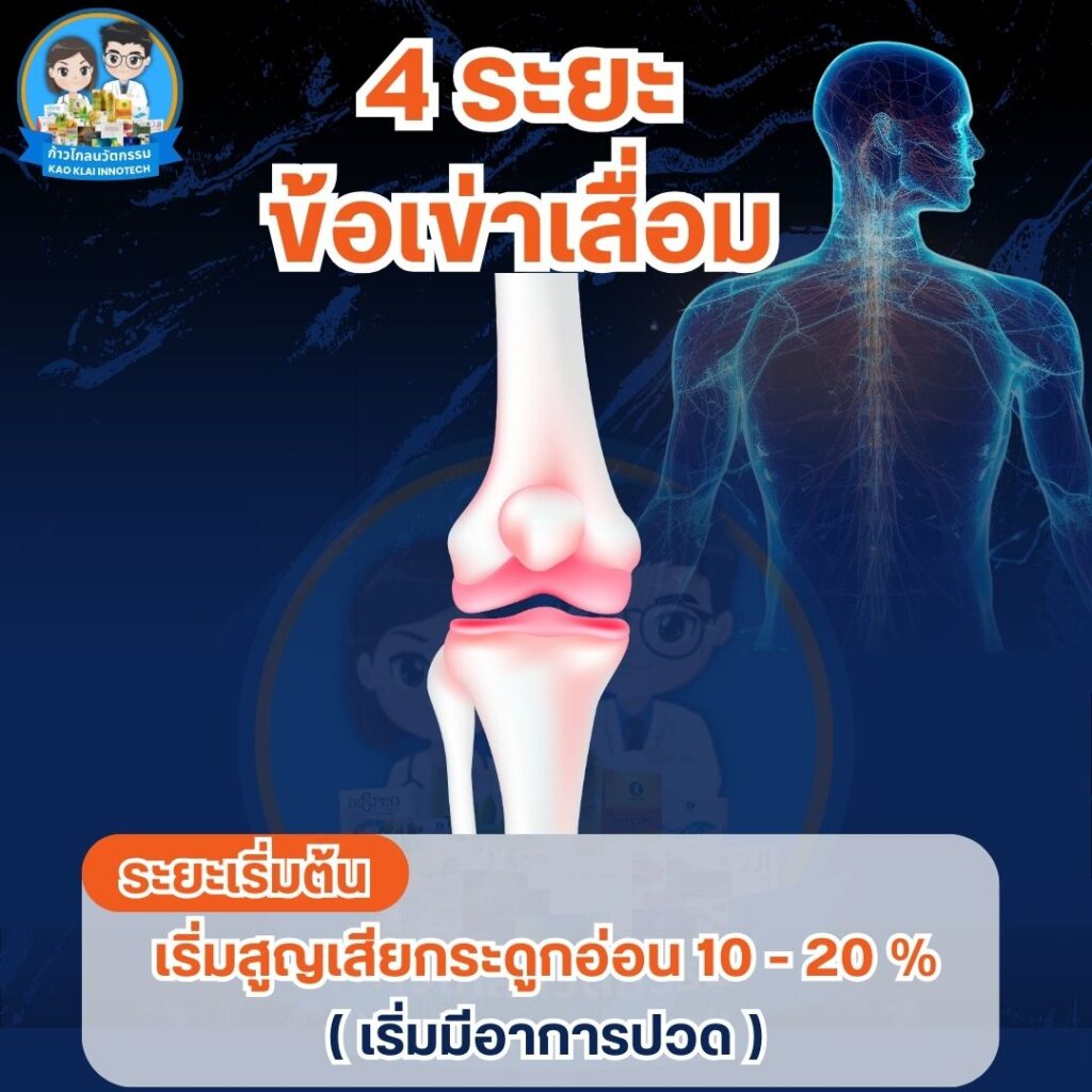 เข่าเสื่อม ปวดเข่า ปวดหัวเข่า (20)
