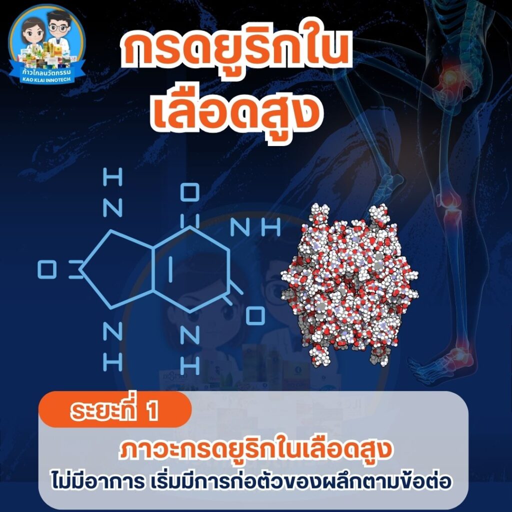 รูมาตอยด์ โรครูมาตอยด์ โรคเกาต์ ข้อเข่าเสื่อม (24)1