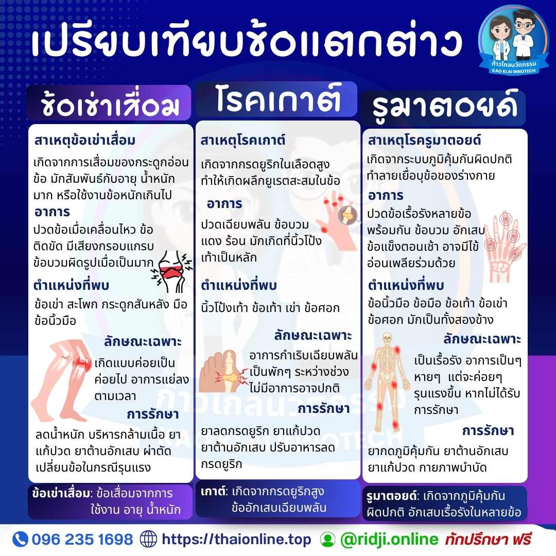 เปรียบเทียบข้อแตกต่าง ข้อเข่าเสื่อม โรคเกาต์ รูมาตอยด์